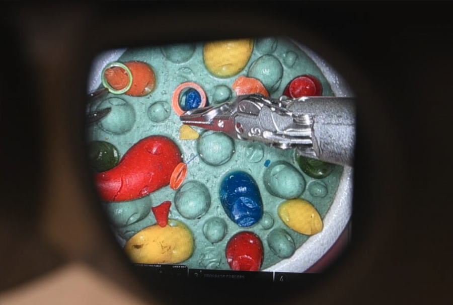 <who> Photo credit: Abby Luciano / North Shore News </who> This look shows what a surgeon sees while using the new robotic system.