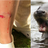 Boy, 10, attacked by otter in ‘unusual and rare’ incident at BC swimming hole