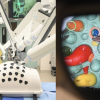 'Less pain for our patients': BC hospital deploys robotic surgical system